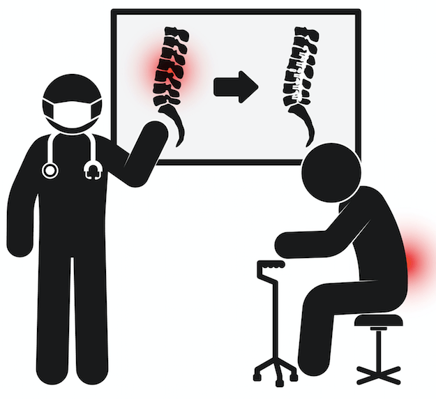 Lumbar decompression surgery